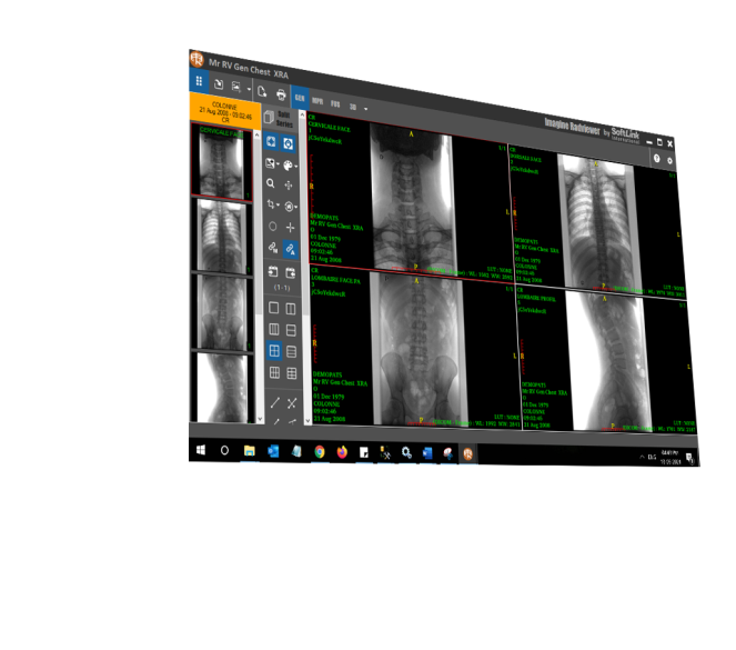 Radviewer Healthcare IT Company in India - SoftLink International